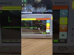 تعرف على سبب اختيار شاشة LCD لمراقبة المريض Mindray BeneView T1 مع غطاء أمامي