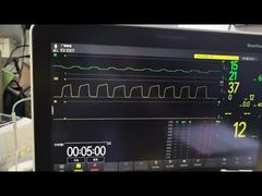 عرض وحدة Mindray AG AG ووحدة O2 وحدة MMS PN 115-023943-00 التجريبي