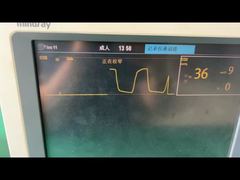 نظرة فاحصة: مصيدة مياه Mindray لوحدة غاز التخدير للأطفال البالغين 9200-10-10530